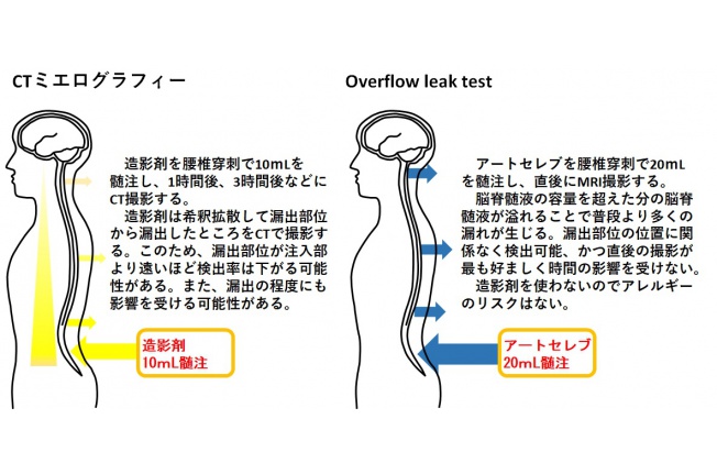 Overflow%20leak%20test.jpg